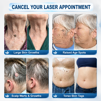 Natravor® 7-𝐃𝐚𝐲 𝐒𝐤𝐢𝐧 𝐓𝐚𝐠 & 𝐒𝐩𝐨𝐭 𝐄𝐫𝐚𝐬𝐞𝐫 𝐂𝐫𝐞𝐚𝐦 (Zero Pain, Zero 𝐒𝐜𝐚𝐫𝐬 Formula) 💎d