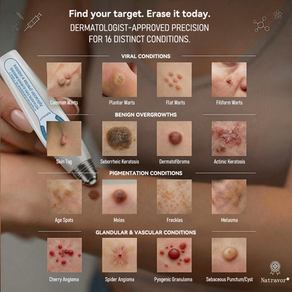 𝐎𝐟𝐟𝐢𝐜𝐢𝐚𝐥 𝐁𝐫𝐚𝐧𝐝 𝐒𝐭𝐨𝐫𝐞 |✅👩‍⚕️Natravor® 7-𝐷𝑎𝑦 𝗧𝐚𝐠 & 𝗦𝗽𝐨𝐭 𝐄𝐫𝒂𝒔𝒆𝒓(Zero Pain, Zero 𝐒𝐜𝐚𝒓𝒔 Rollerball)c