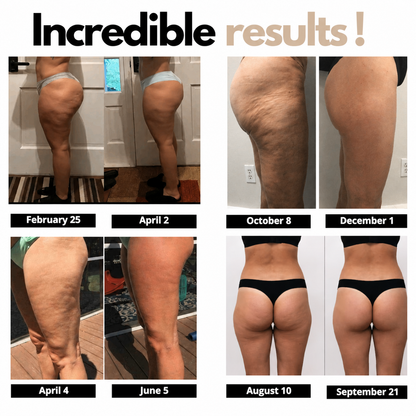 Natravor® Flex Shape Leggings