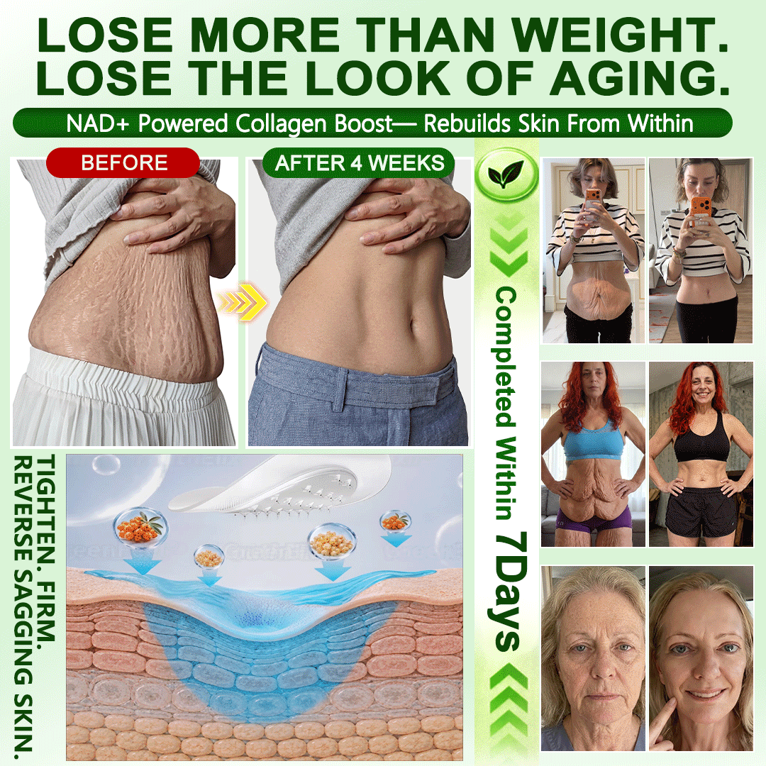 𝑶𝒇𝒇𝒊𝒄𝒊𝒂𝒍 𝑺𝒕𝒐𝒓𝒆 | 𝐍𝐞𝐰!🍀𝐍𝐚𝐭𝐫𝐚𝐯𝐨𝐫® 𝐁𝐫𝐨𝐰𝐧 𝐒𝐞𝐚𝐰𝐞𝐞𝐝× 𝐁𝐞𝐫𝐛𝐞𝐫𝐢𝐧𝐞× 𝐍𝐃𝐀+ 𝟏𝟎-𝐢𝐧-𝟏 𝐍𝐚𝐧𝐨 𝐌𝐢𝐜𝐫𝐨𝐧𝐞𝐞𝐝𝐥𝐞 𝐏𝐚𝐭𝐜𝐡(𝐉𝐮𝐬𝐭 𝐨𝐧𝐜𝐞 𝐚 𝐝𝐚𝐲, 𝐯𝐢𝐬𝐢𝐛𝐥𝐞 𝐜𝐡𝐚𝐧𝐠𝐞𝐬 𝐢𝐧 𝟕 𝐝𝐚𝐲𝐬）𝘽𝙚𝙧𝙗𝙚𝙧𝙞𝙣𝙚 + 𝐁𝐫𝐨𝐰𝐧 𝐒𝐞𝐚𝐰𝐞𝐞𝐝 𝙁𝙤𝙧𝙢𝙪𝙡𝙖 ✅ 𝐅𝐨𝐫 𝐨𝐛𝐞𝐬𝐢𝐭𝐲, 𝗟𝗼𝗼𝘀𝗲 𝘀𝗸𝗶𝗻,𝐝𝐢𝐚𝐛𝐞𝐭𝐞𝐬, 𝐬𝐥𝐞𝐞𝐩 𝐚𝐩𝐧𝐞𝐚, 𝐣𝐨𝐢𝐧𝐭 𝐢𝐬𝐬𝐮𝐞𝐬, 𝐚𝐧𝐝 𝐦𝐨𝐫𝐞💯💯